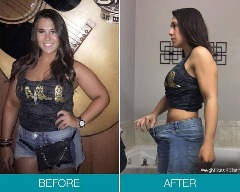 Take Control of Your Overeating - Get $1,500 OFF Obalon!* 65d Dana BA weightloss lbs