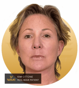 Kim Ottone - A Wave patients testimonial image