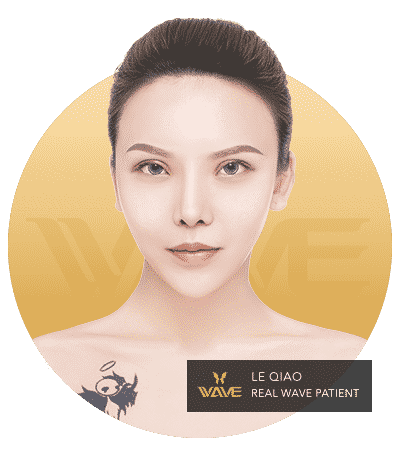 Le Qiao - A Wave patients testimonial image