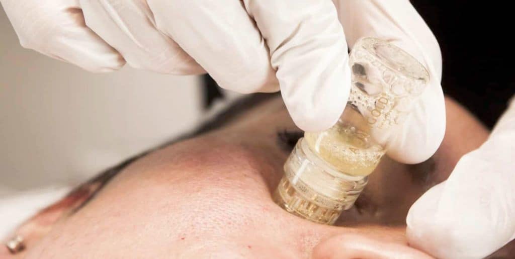 Aquagold being put onto a womans face