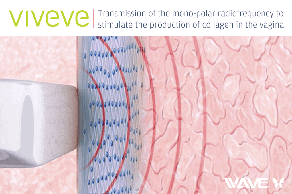 viveve website banner