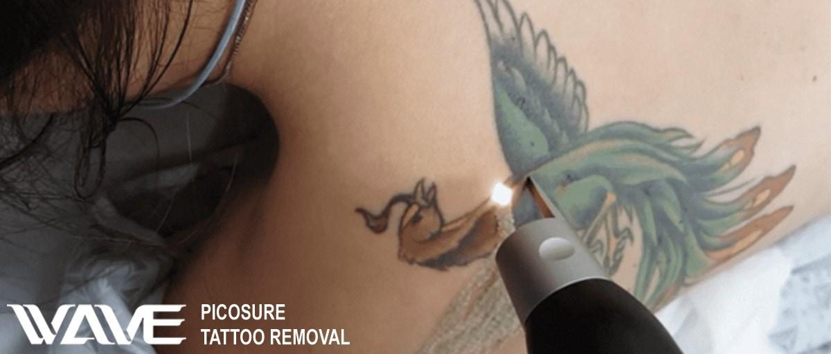 Picosure Wave Plastic Surgery Blog Banner