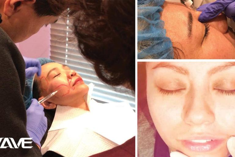 WAVE BLOG POST IMAGE