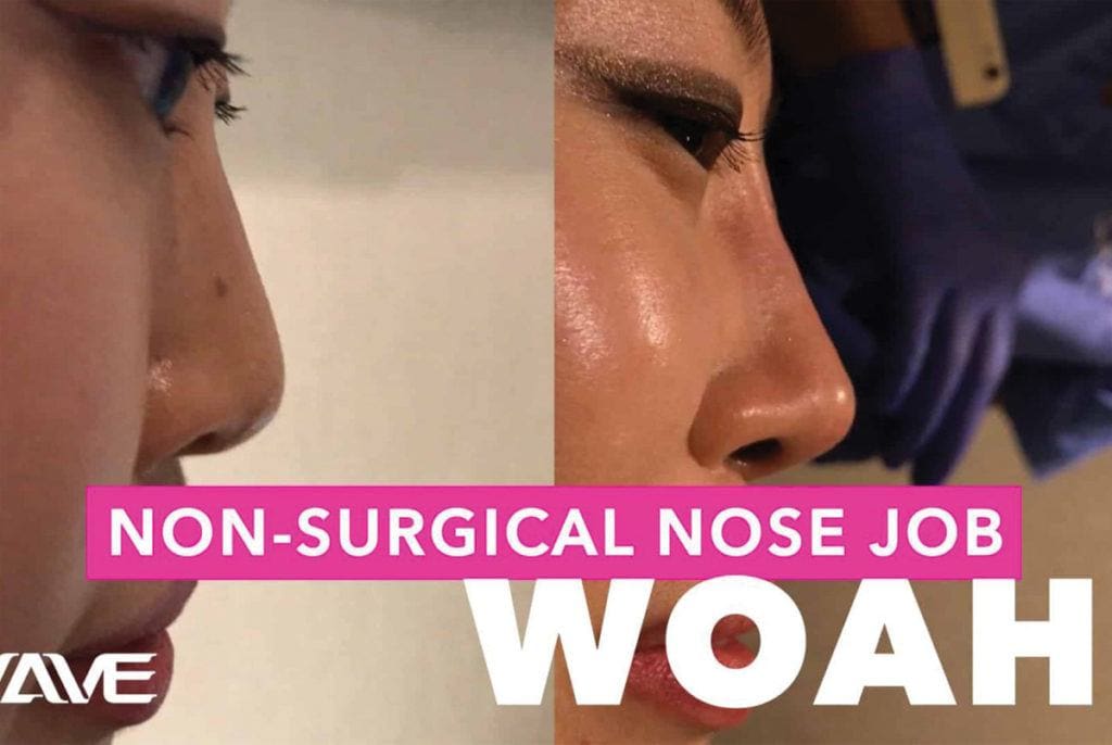 Non Surgical Nose Job Blog Post Image