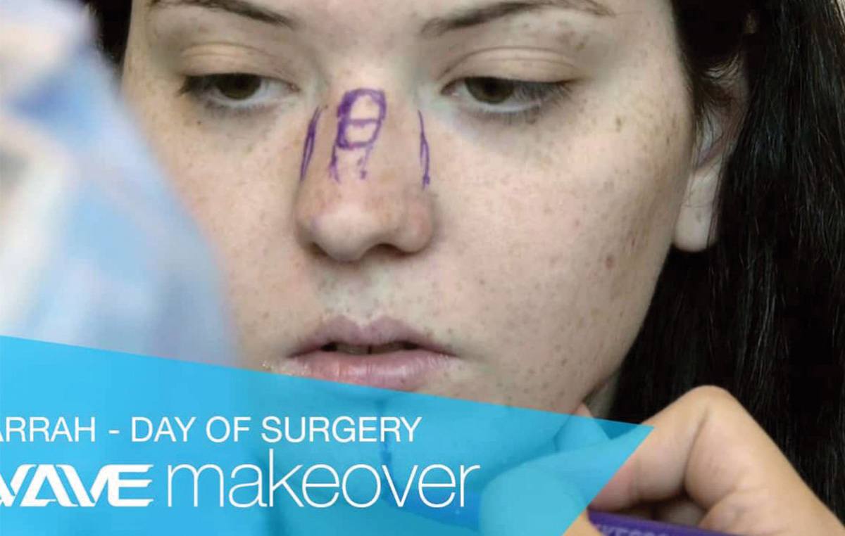 arrah Day of Surgery Wave Make Over Wave Blog Banner