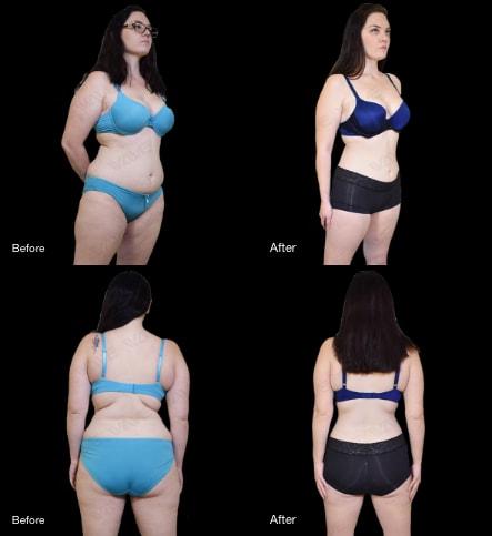 weight loss before and after