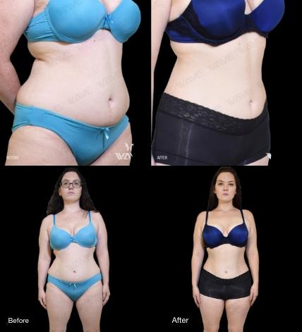 weight loss before and after