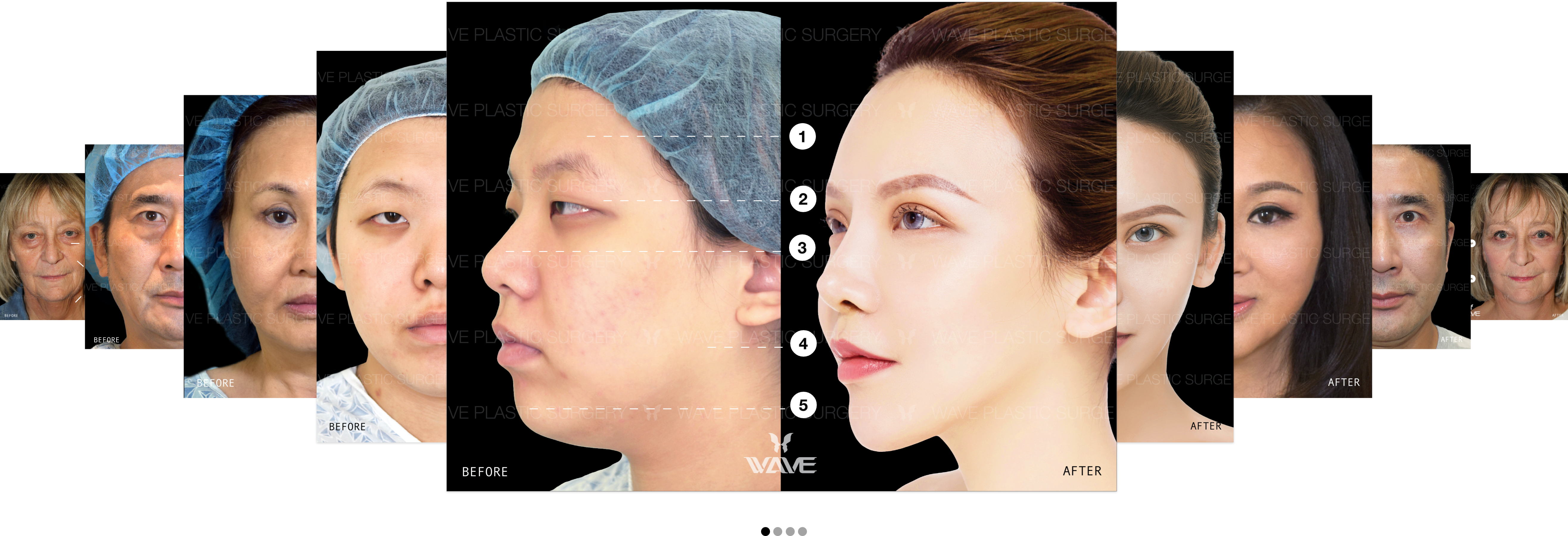plastic surgery before and after