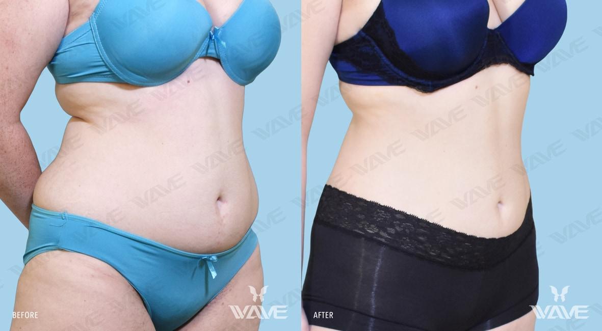 Body FARRAH M MEDI E