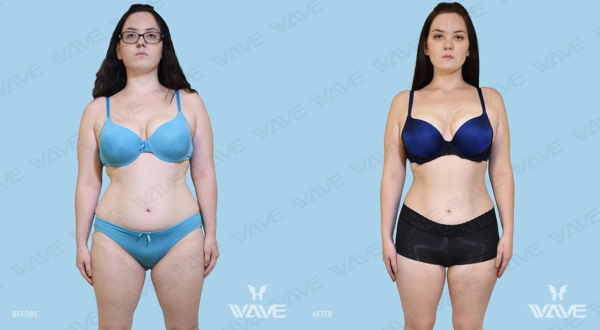 Body FARRAH M MEDI E FULL