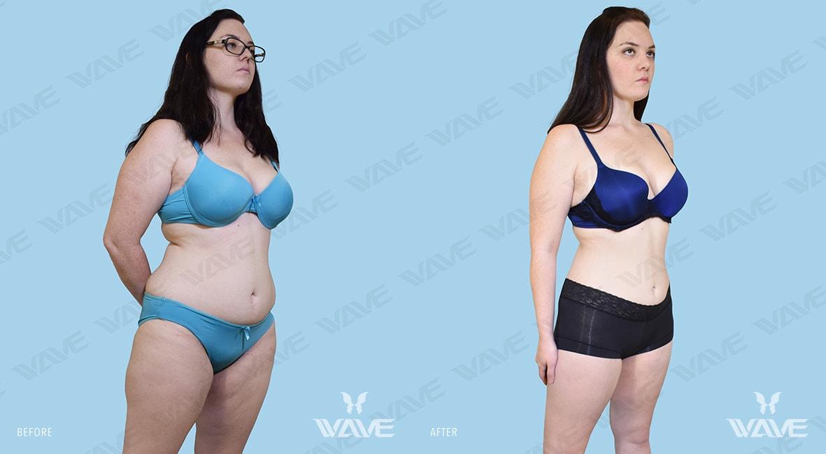 Body FARRAH M MEDI E FULL 2