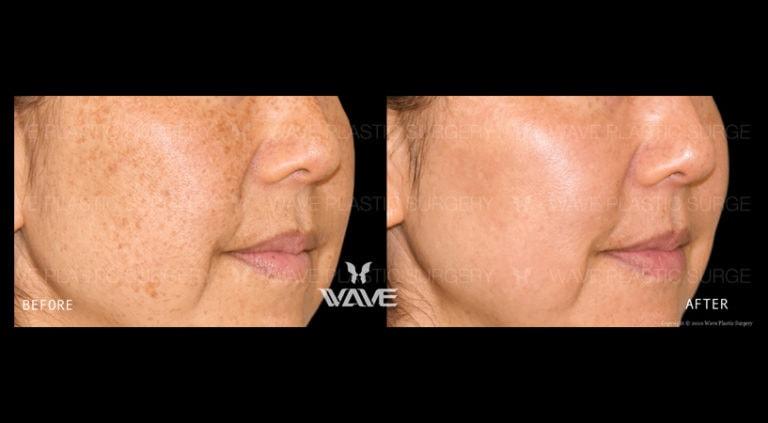 Lumecca_BA_Website_Watermark-01 boxed