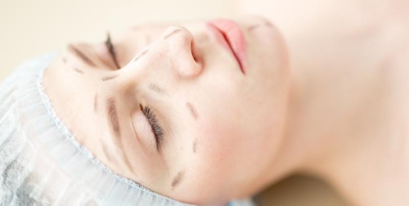 Candidates for a facelift