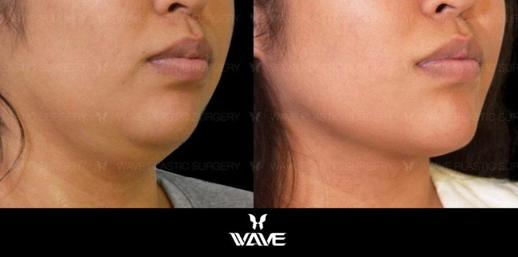 Wave Models Program models page banda 11