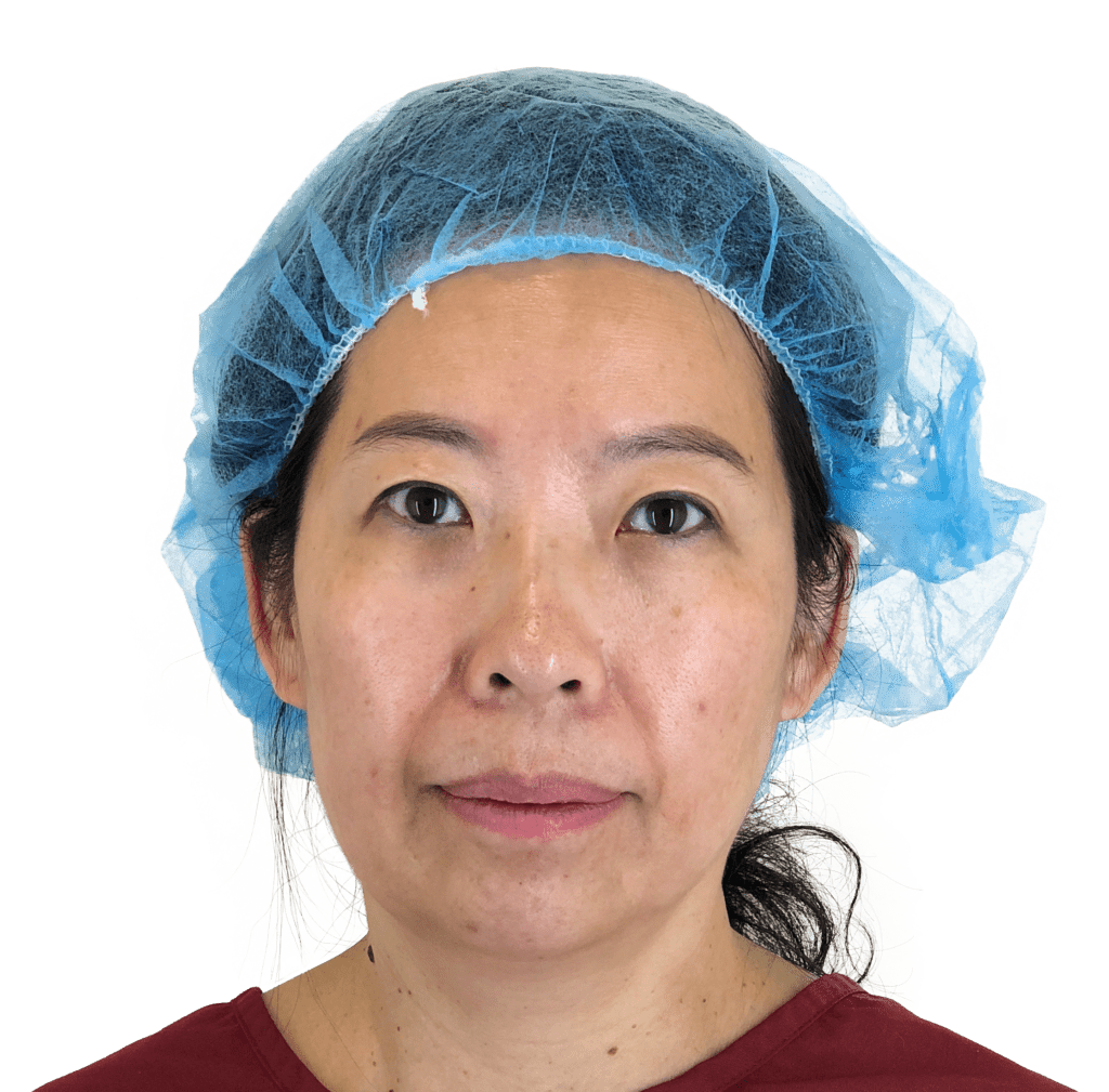 Anti-Aging Treatments For People in Their 30s, 40s, 50s, 60s, and 70s 000 BEFORE