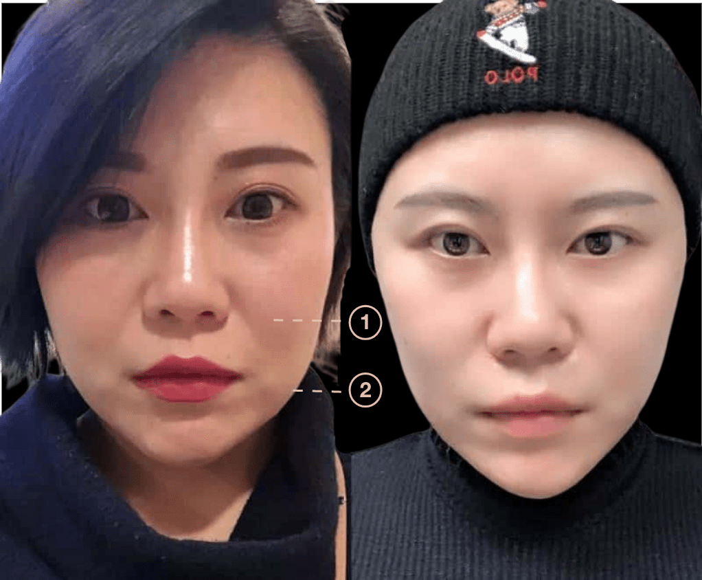 Anti-Aging Treatments For People in Their 30s, 40s, 50s, 60s, and 70s Group 138