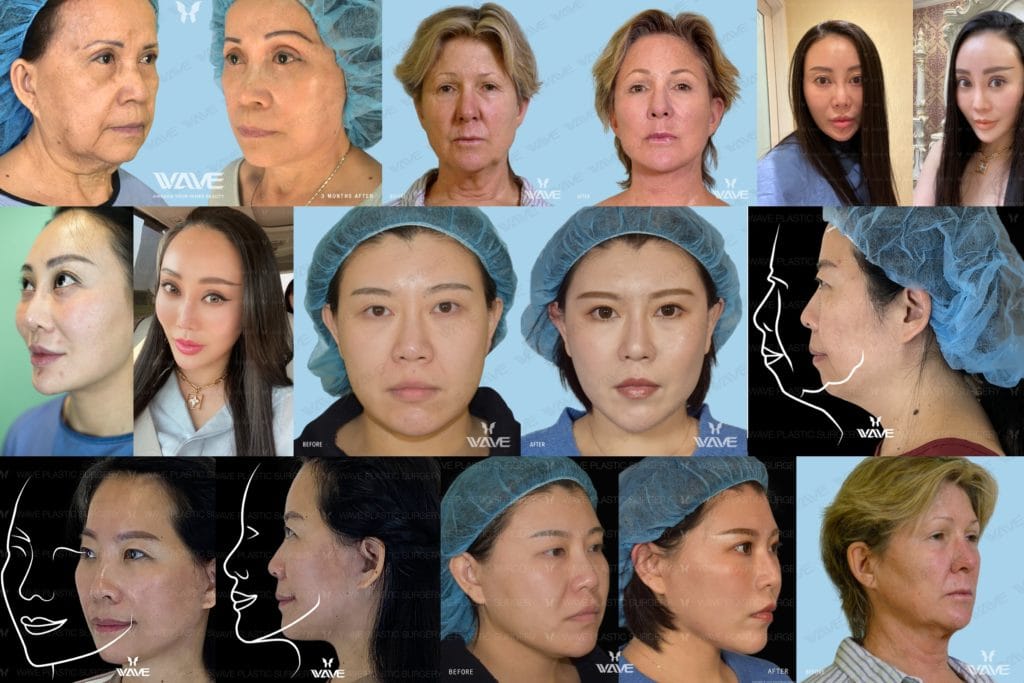 Anti-Aging Treatments For People in Their 30s, 40s, 50s, 60s, and 70s anti aging hero 4