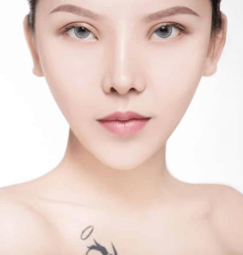 Skin Tightening SkinTighMobile