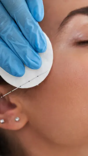 Fillers: A woman is getting filler injections in her cheek bone