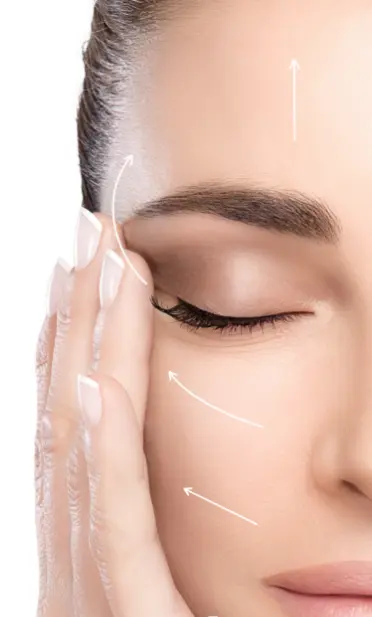 Mini face lift: an arrow goes upward along a woman's cheek, and upwards along her brow bone