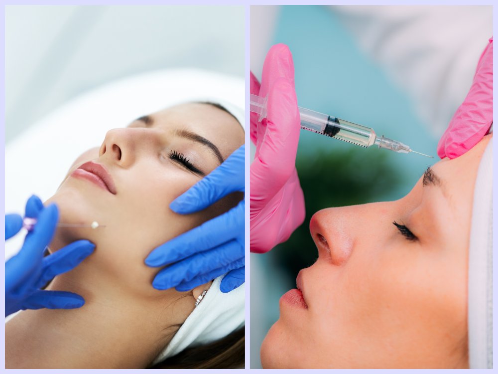 Choosing the Right Procedure: Fillers vs. Thread Lifts