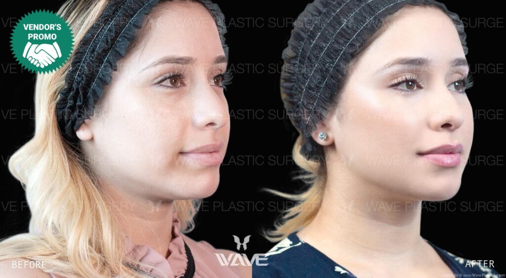 Specials wave injections special 2