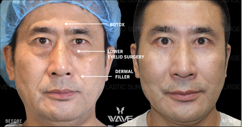 older male plastic surgery patient