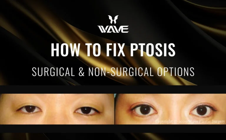 How to Fix Ptosis: Surgical & Non-Surgical Options; Ptosis Correction before and after
