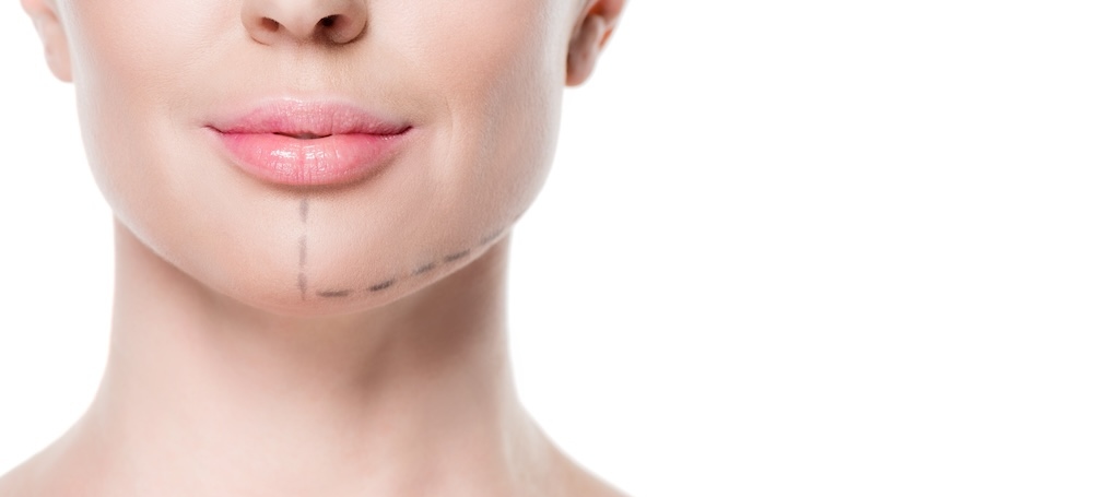 Cropped view of woman with painted lines on face for plastic surgery