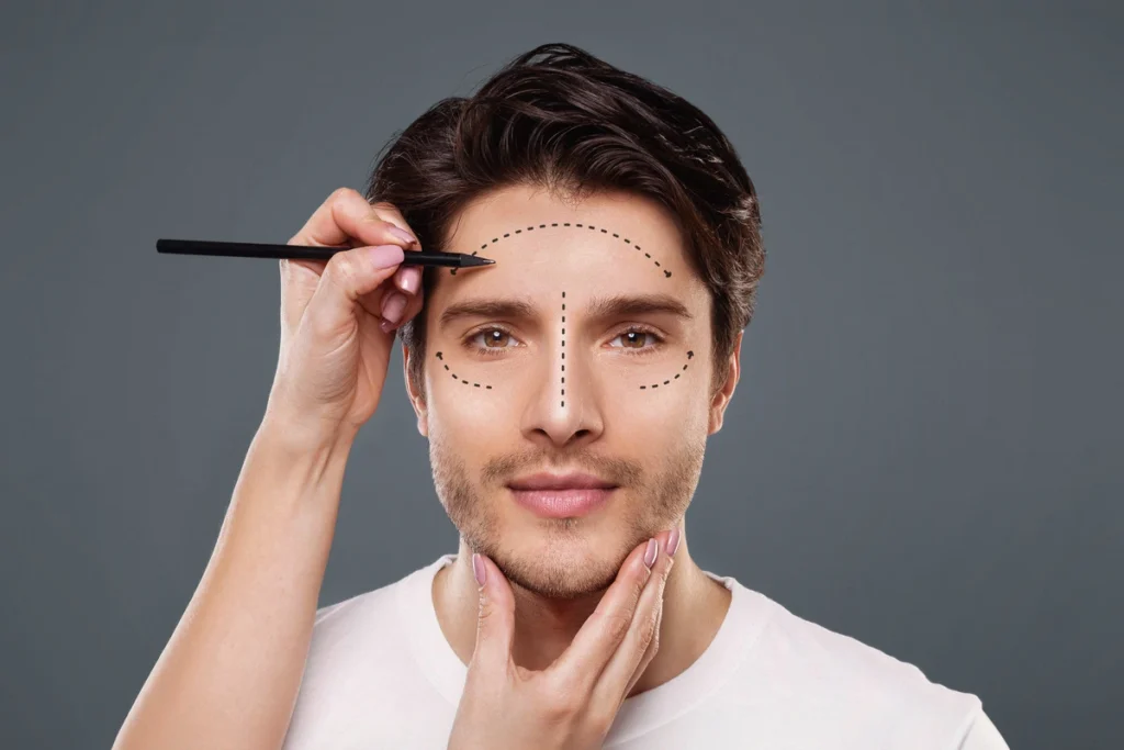 can men get a ponytail face lift - surgeon marking areas on a man's face