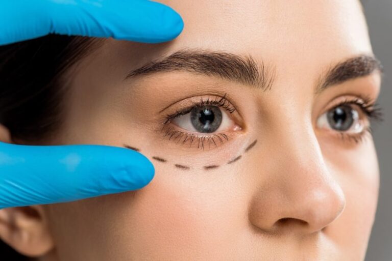 Close up of gloved surgeon hand measuring eye height of young brunette woman with surgical marks underneath her eye