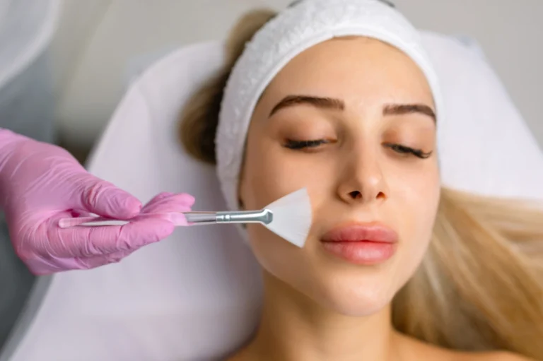 Understanding Chemical Peels - Duration, Benefits, and Care - female getting chemical peel - facial treatment