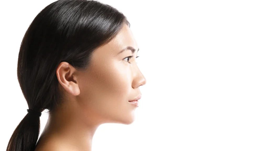 Non-Surgical Ptosis Correction