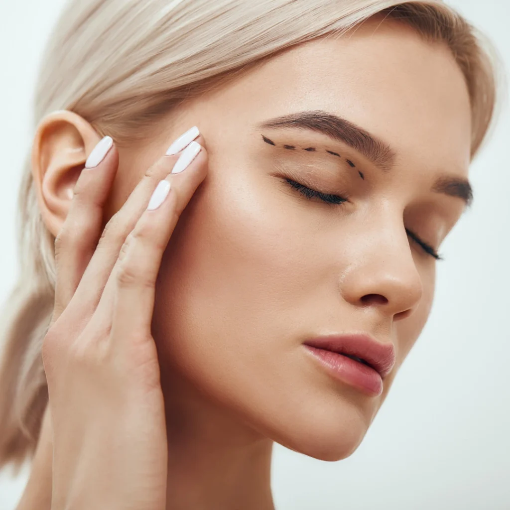 eyelid crease specifications - upper bleph