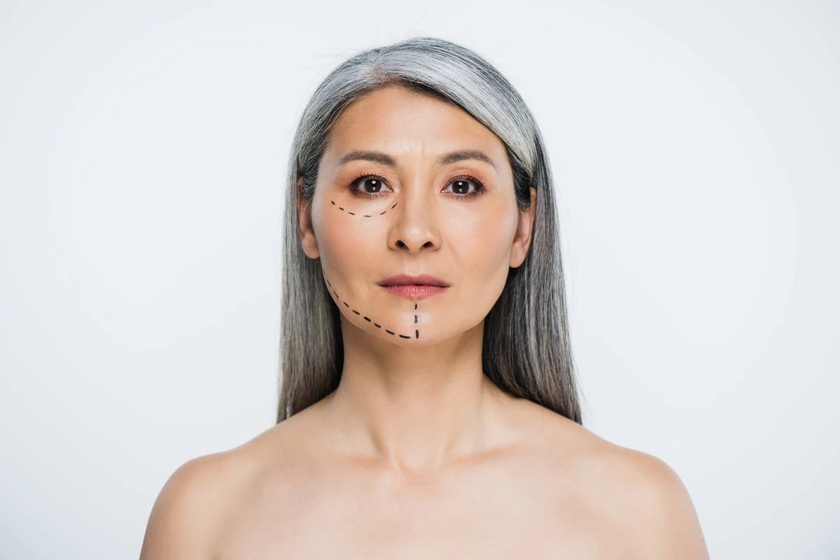Mini Facelift vs Mid-Facelift