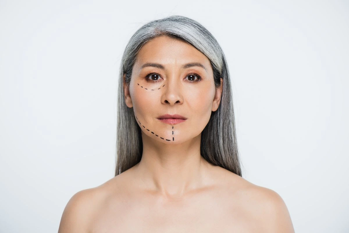 modern facelifts without being overdone