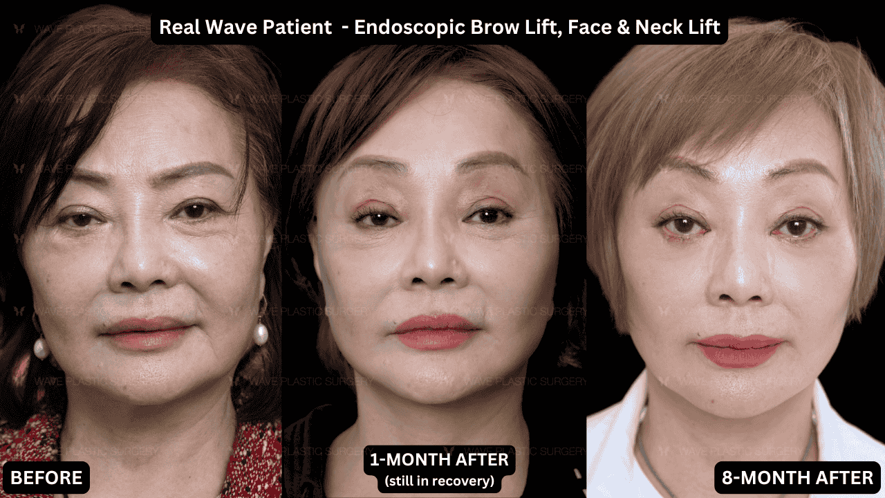 Wave-Plastic-Surgery-Promo
