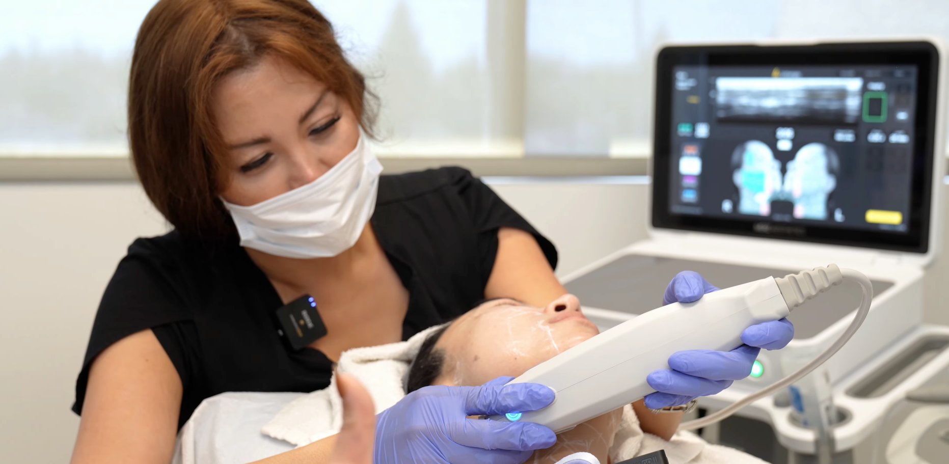 Wave-Plastic-Surgery-Ultherapy