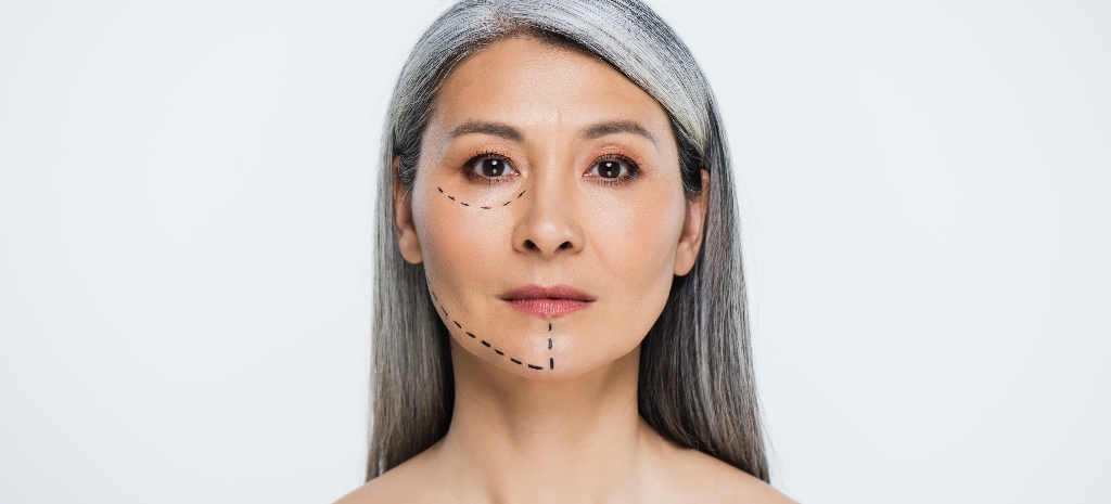 attractive asian woman with plastic surgery lines on face isolated on grey, representing healing from facelift surgery in orange county, los angeles, san francisco