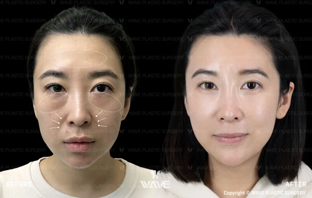 Specials Pyramid Rejuvenation